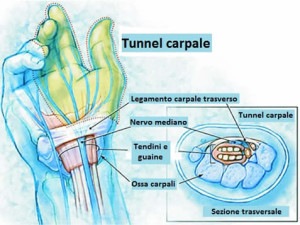 tunnel-carpale